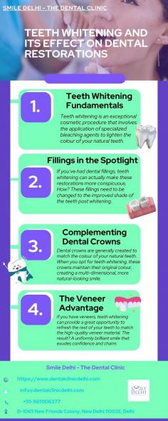 Teeth Whitening & Its Effect on Dental Restoration