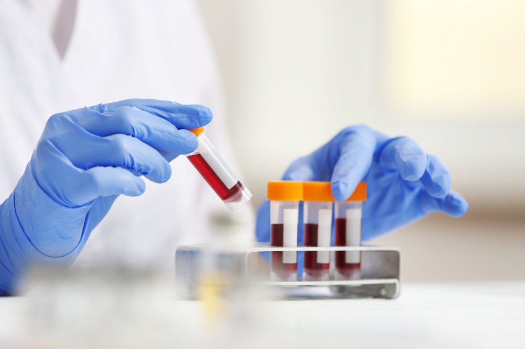 Unique Lab Services: Mobile Blood Work in Washington - AtoAllinks
