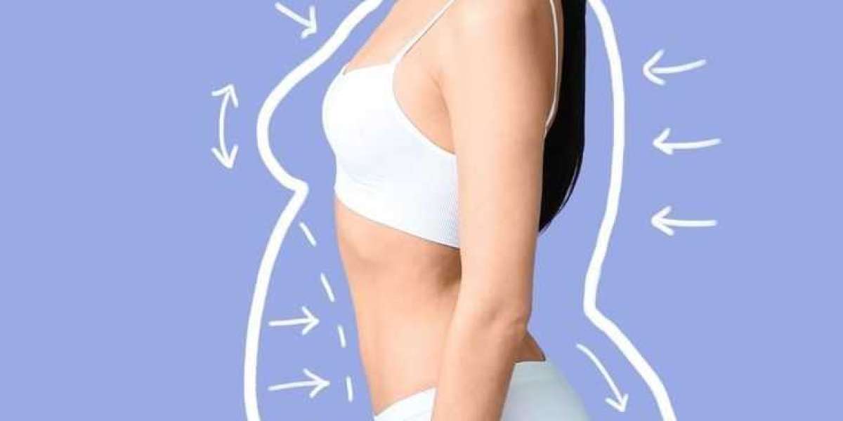 Unlock Your Ideal Weight: Discover Effective Weight Loss Supplements in Pakistan